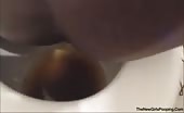 Black girl with diarheea