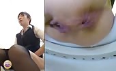 Japanese teen with serious diarheea