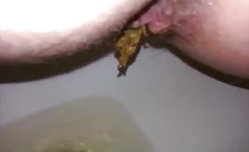 Hairy wife pooping while her husband records