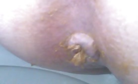 Tiny turd stuck in his ass