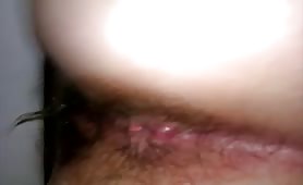 Hairy wife pooping