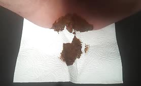 Creamy shit on a white napkin