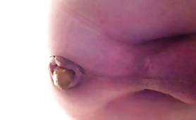 Ugly purple asshole