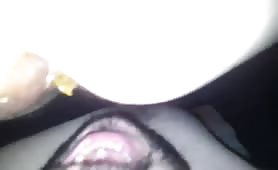 Diarheea on his entire face