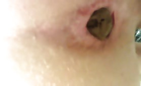 Asshole in close up