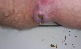Long yellow crap