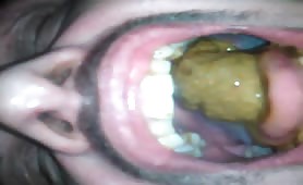 Trying to swallow