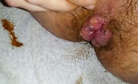 Hairy guy shoving fingers in his asshole, pulling out fresh shit