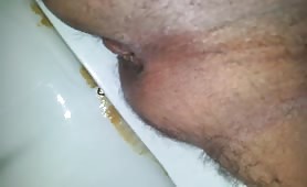 Shit from hairy ass