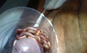 Turd and worms in a cup held to his crotch