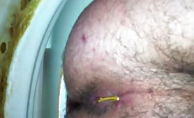 Yellow shit on his asshole