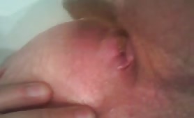 Shit stuck in ass