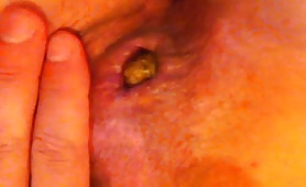 Poop in close up