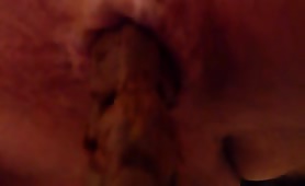 Asshole in close up