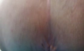 Yellow poop in close up