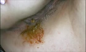 Girl Poops Good