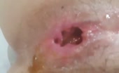 Fingering pussy while pooping