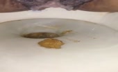 Yellow shit from hairy ass