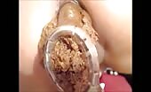 Speculum and stinky poop closeup 