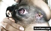 Girl With Black Hairy Pussy Shits And Fart For Us